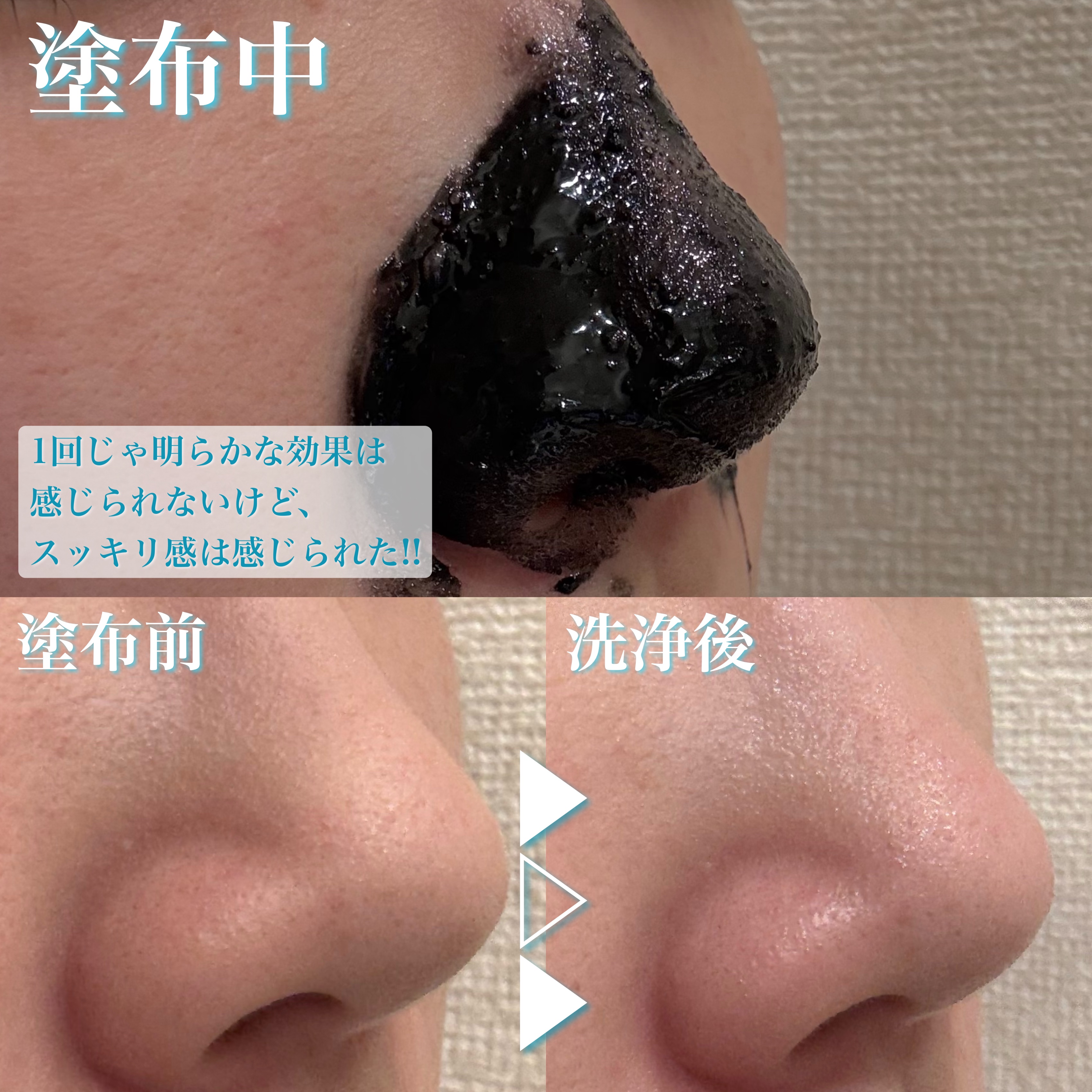 ディズム　エンリッチ　バブルネット/DISM/その他スキンケアグッズを使ったクチコミ（3枚目）