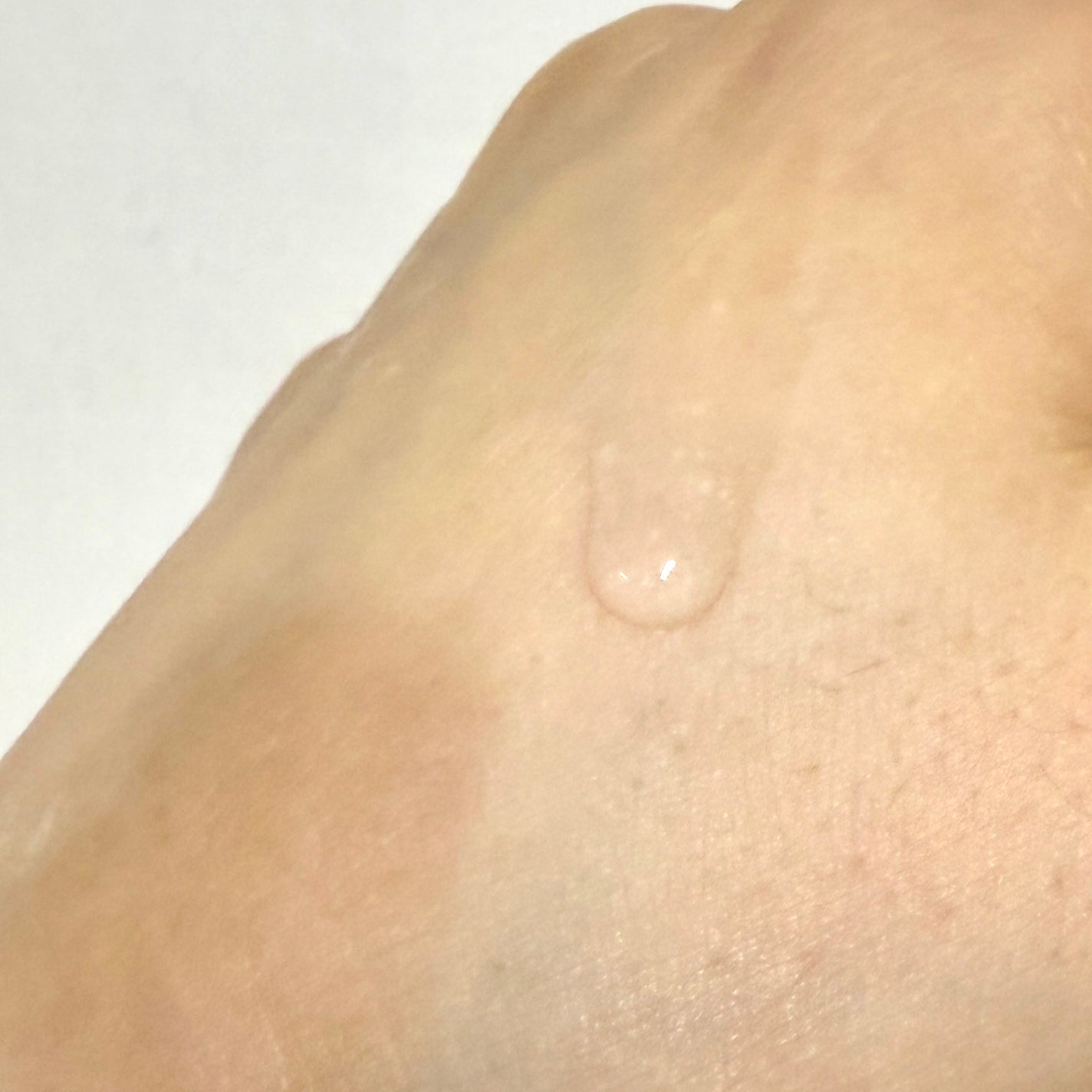 シークレットソリューションPDRNカプセルアンプル/It's skin/美容液を使ったクチコミ(3枚目)