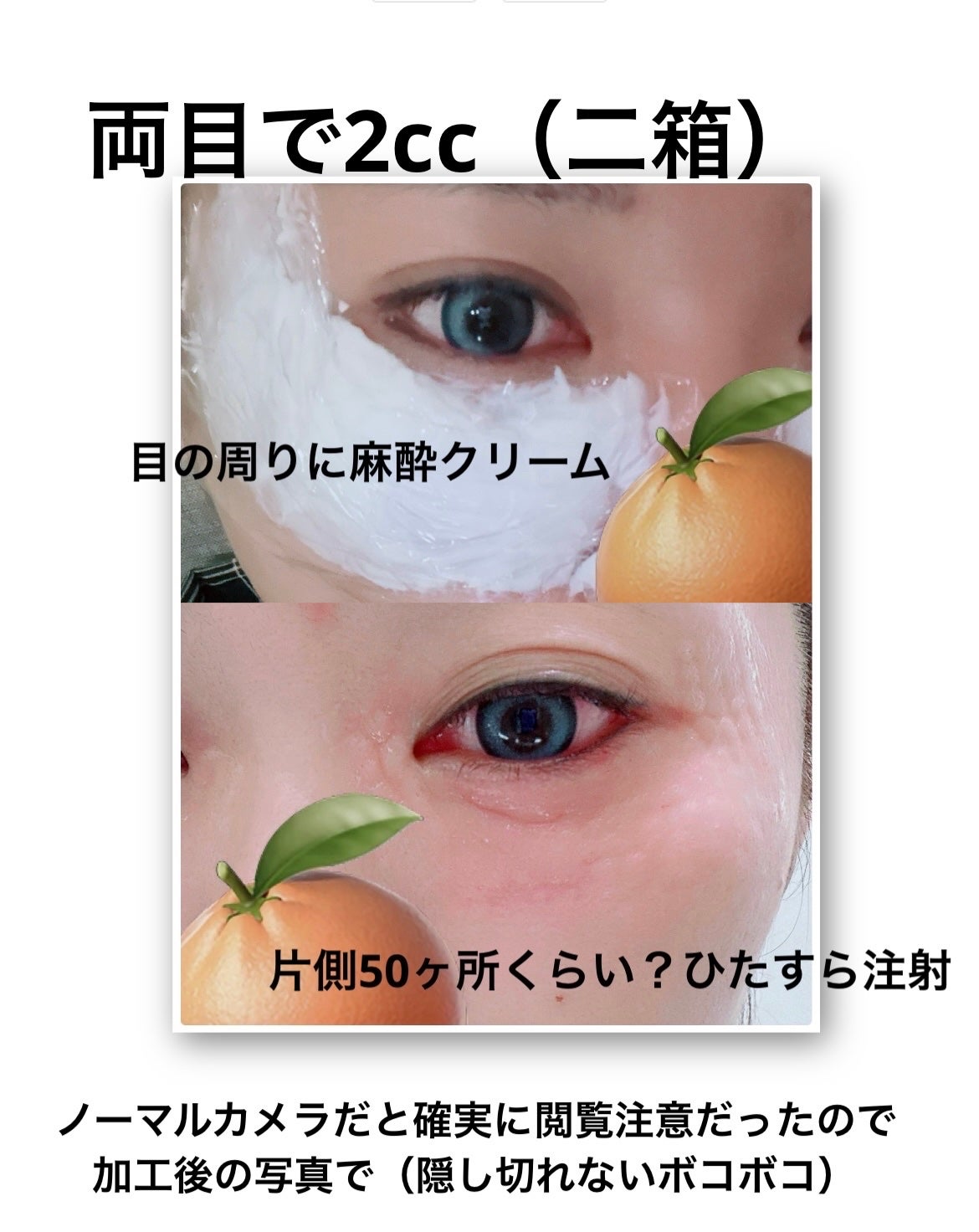 ã¡ãð on LIPS ãå
é±éåœã«é£ã³ç«ã£ãŠããŸããðââïžâïžð°ð·ä»å¹Ž2åç®ã®éåœã..ãïŒ4æç®ïŒ