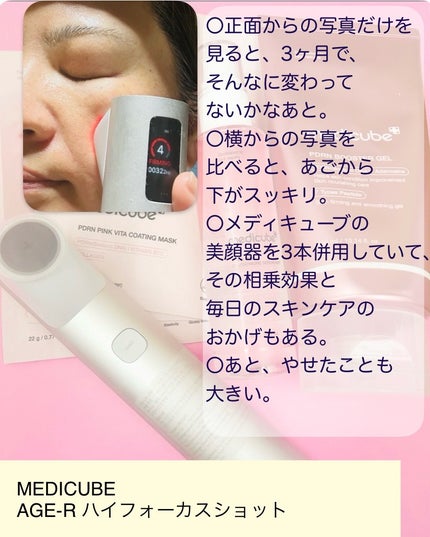 AGE-R ハイフォーカスショット/MEDICUBE/美顔器・マッサージを使ったクチコミ(4枚目)
