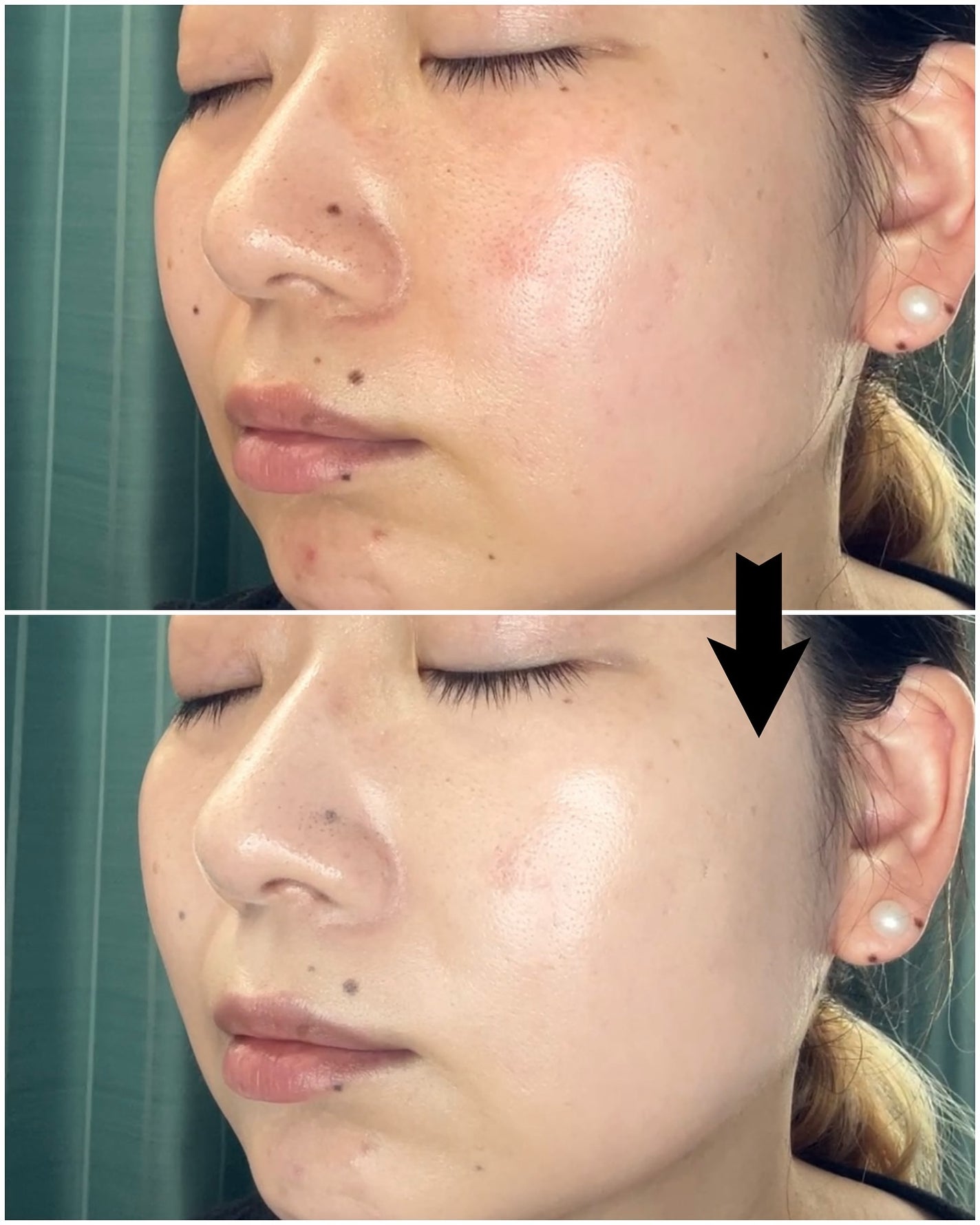 ハートリーフシーンカバークッション/23years old/クッションファンデーションを使ったクチコミ(6枚目)