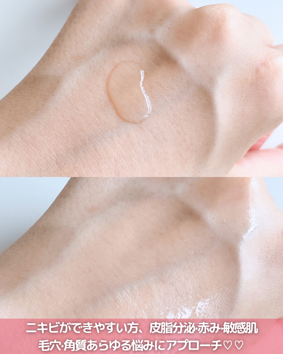 AZアゼライン酸15セラム/コスデバハ/美容液を使ったクチコミ（3枚目）