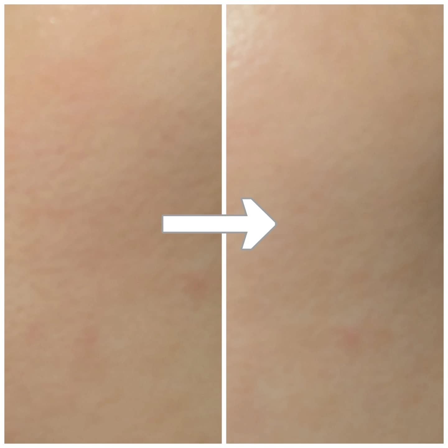 プレミアムもちソープ「グリーンアルティザン」/アレンシア/その他洗顔料を使ったクチコミ（2枚目）