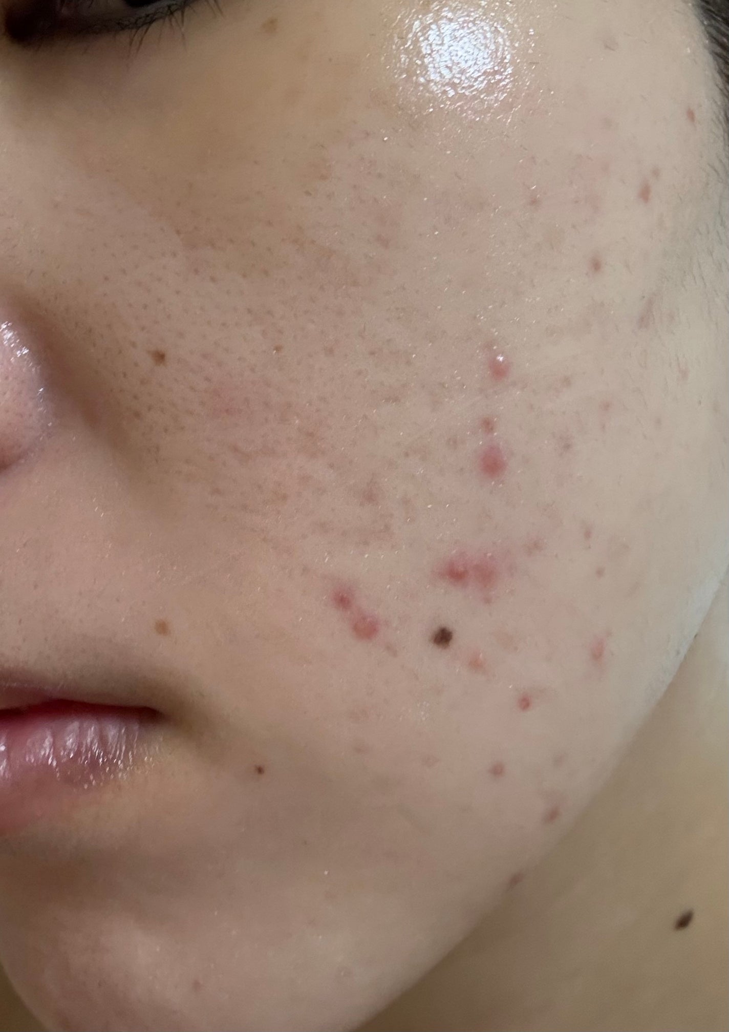 潤浸保湿 化粧水 III とてもしっとり/キュレル/化粧水を使ったクチコミ(1枚目)