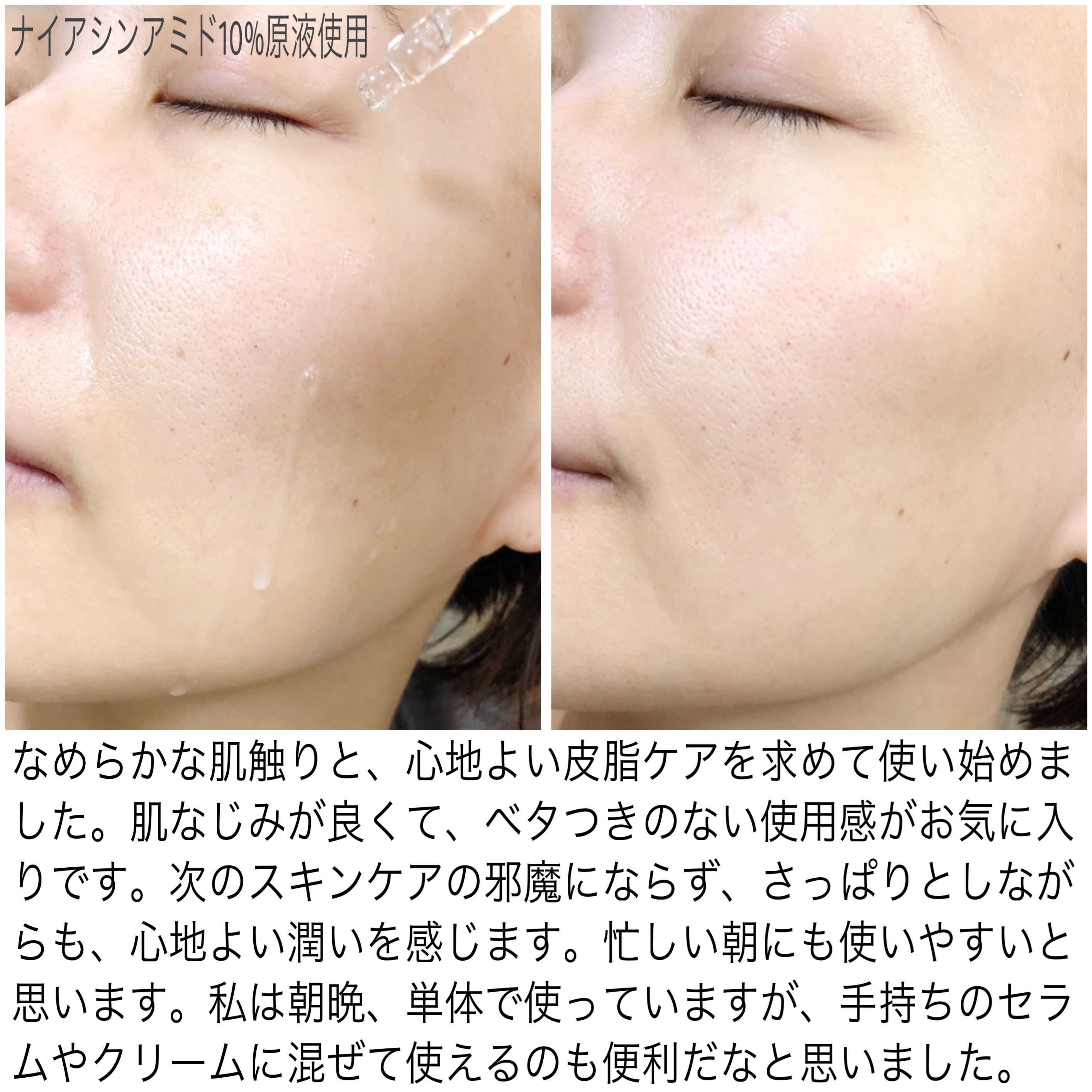ナイアシンアミド10%原液/Organicity/美容液を使ったクチコミ（3枚目）