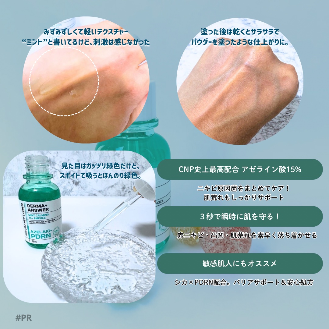 ダーマアンサーアゼライン酸ミントアンプル/CNP Laboratory/美容液を使ったクチコミ（2枚目）