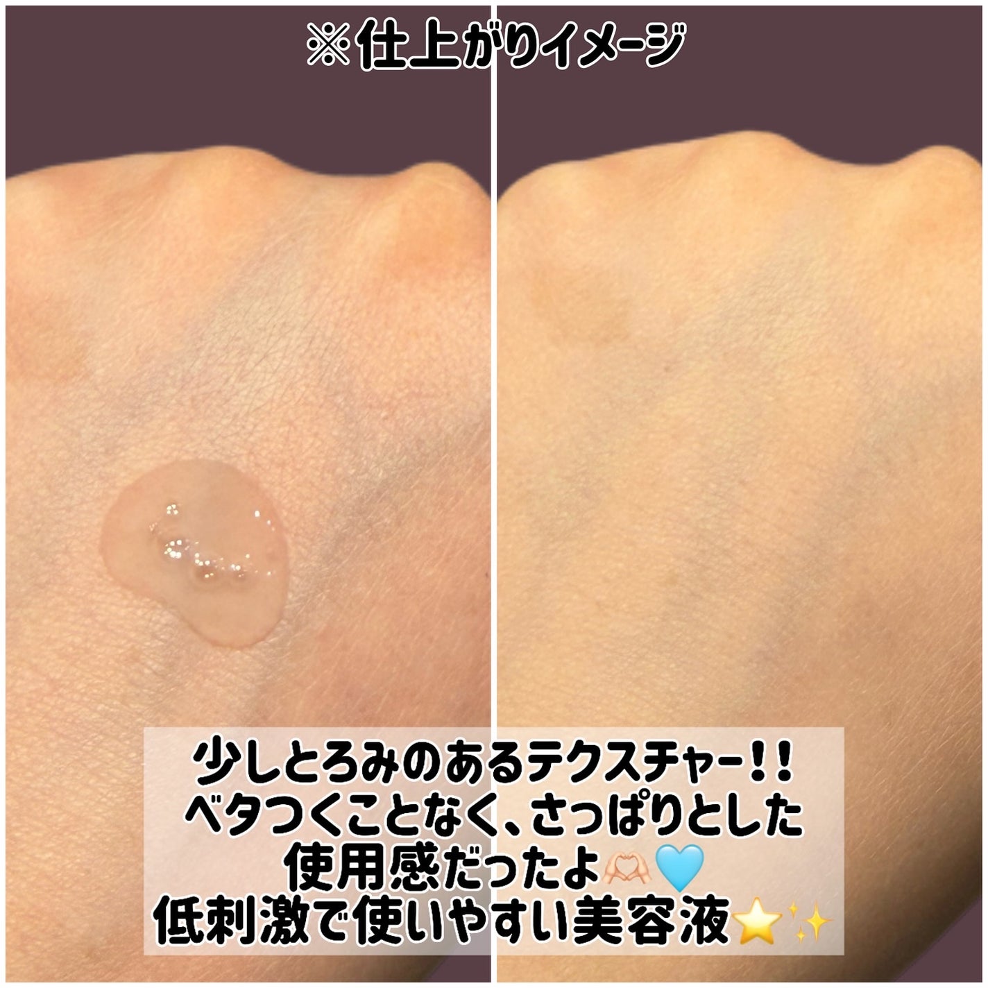 バイオスキンエッセンスプラス/Bionist (ビオニスト)/美容液を使ったクチコミ(3枚目)