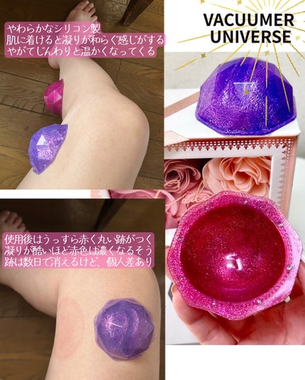 VACUUR UNIVERSE/VACUUMER/ツボ押し・マッサージグッズを使ったクチコミ(4枚目)