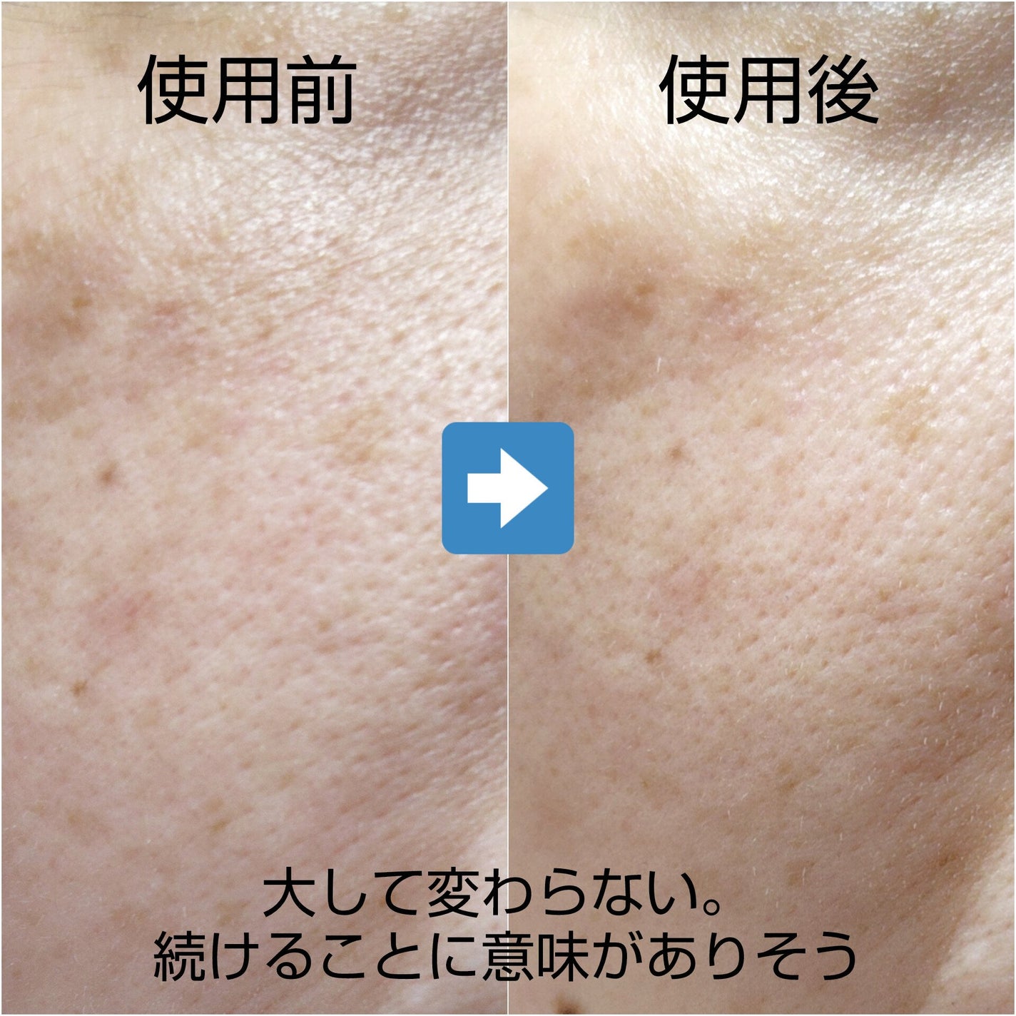 ダーマレーザースペクター ウルセラCMAX/クオリティファースト/美容液を使ったクチコミ(3枚目)