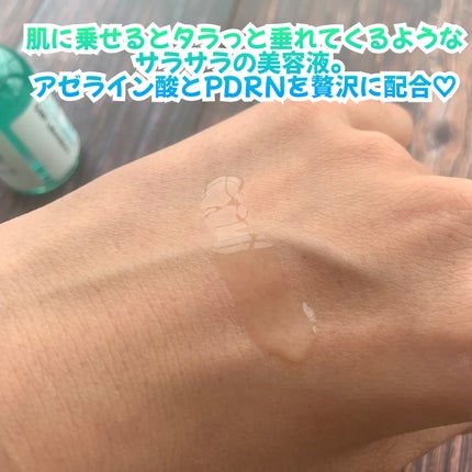 ダーマアンサーアゼライン酸ミントアンプル/CNP Laboratory/美容液を使ったクチコミ(3枚目)
