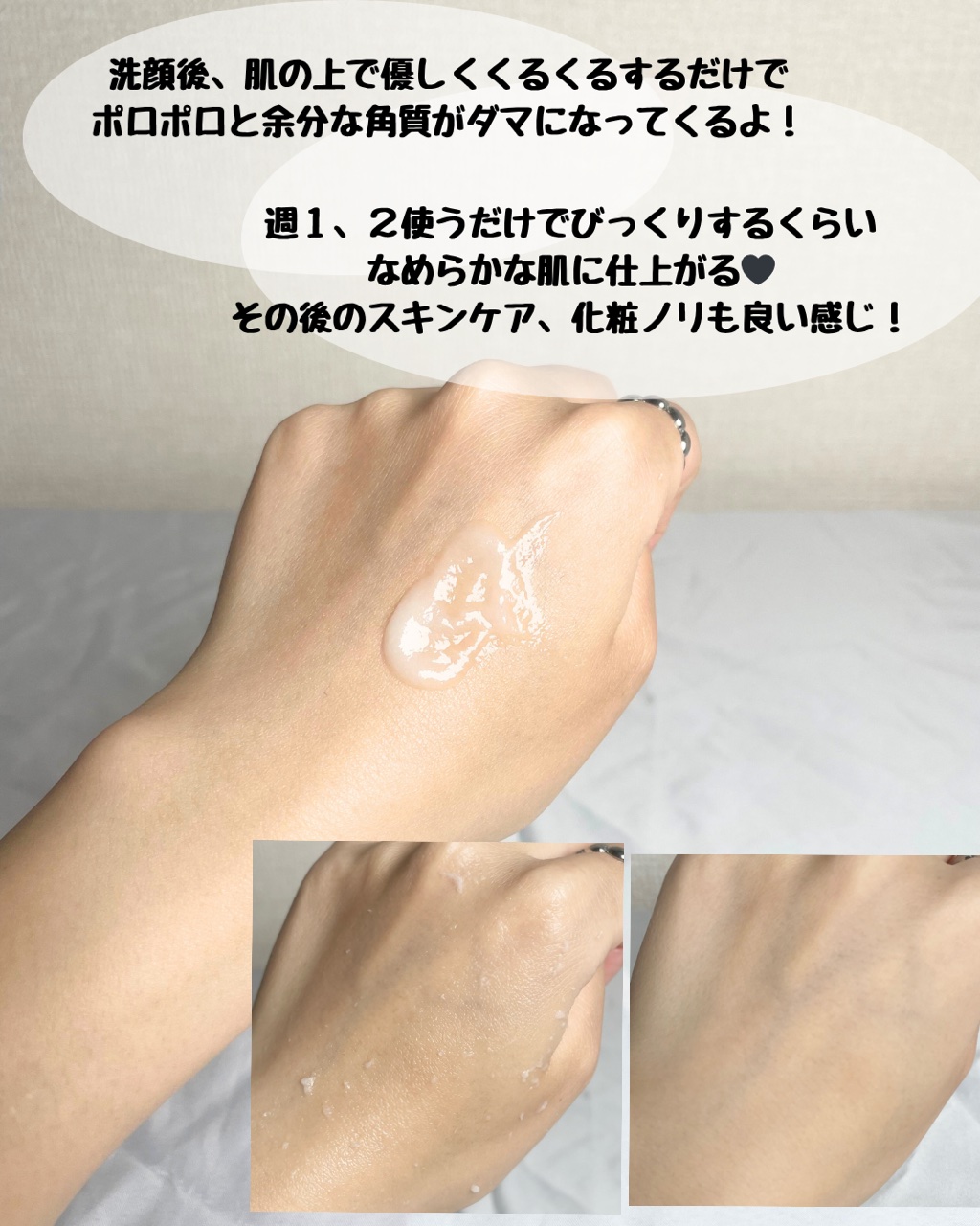 アルファ ナイアシン スムースピーリングジェル/ShionLe/ピーリングを使ったクチコミ（3枚目）