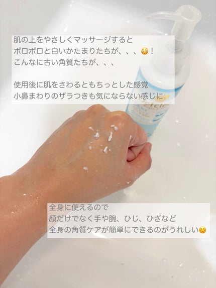 DETクリア ブライト&ピール ピーリングジェリー<無香料タイプ>/Detclear/ピーリングを使ったクチコミ(4枚目)