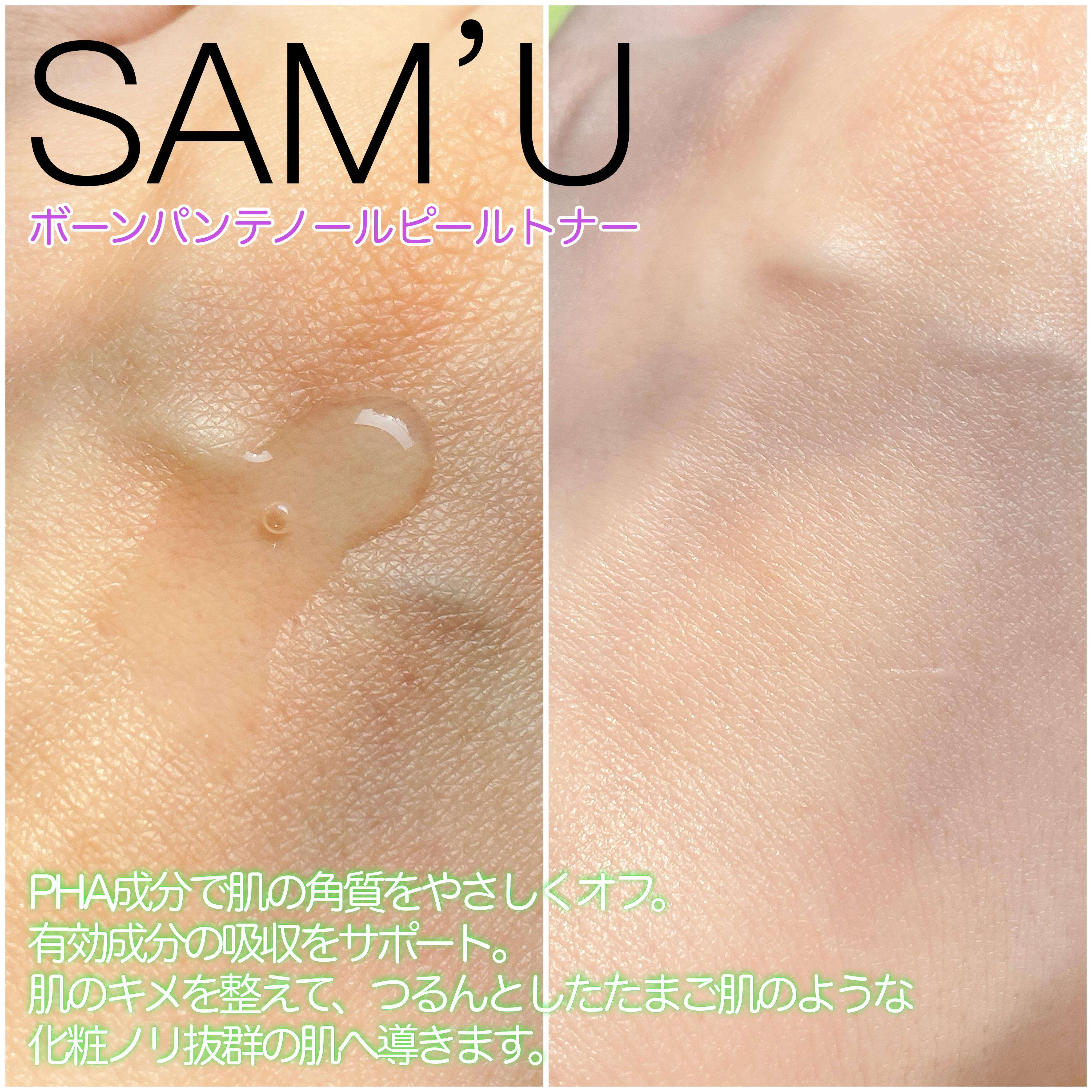 ボーンパンテノールピールトナー/SAM'U/化粧水を使ったクチコミ（3枚目）
