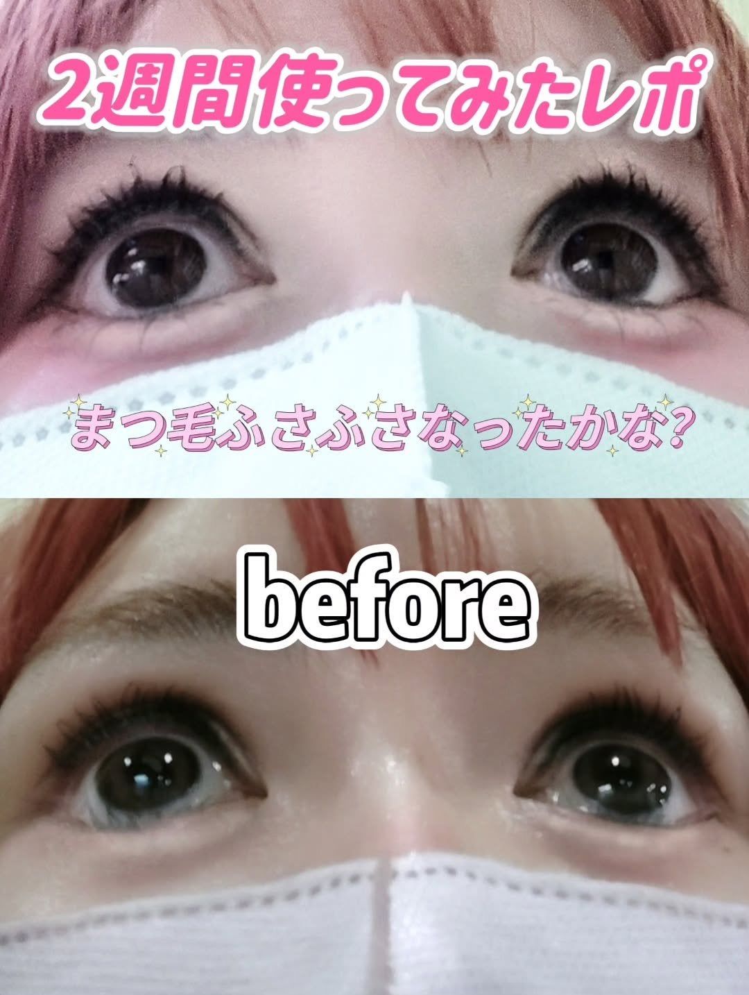 ポッケのお姫様💖🐈⬛フォロバ100%♡ on LIPS 「\まつ毛も、生え際も。/100%ビーガン✨まつ毛美容液【ビオテ..」(3枚目)