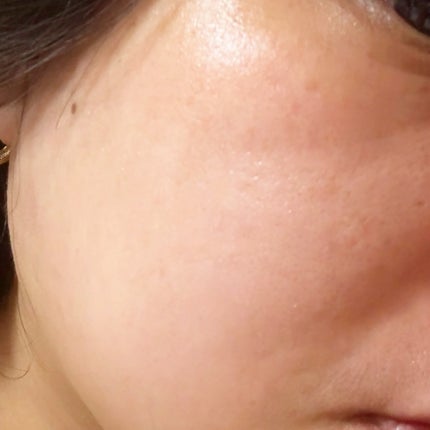 ブラックPDRN デイリーシートマスク/ネイチャーリパブリック/シートマスク・パックを使ったクチコミ(5枚目)