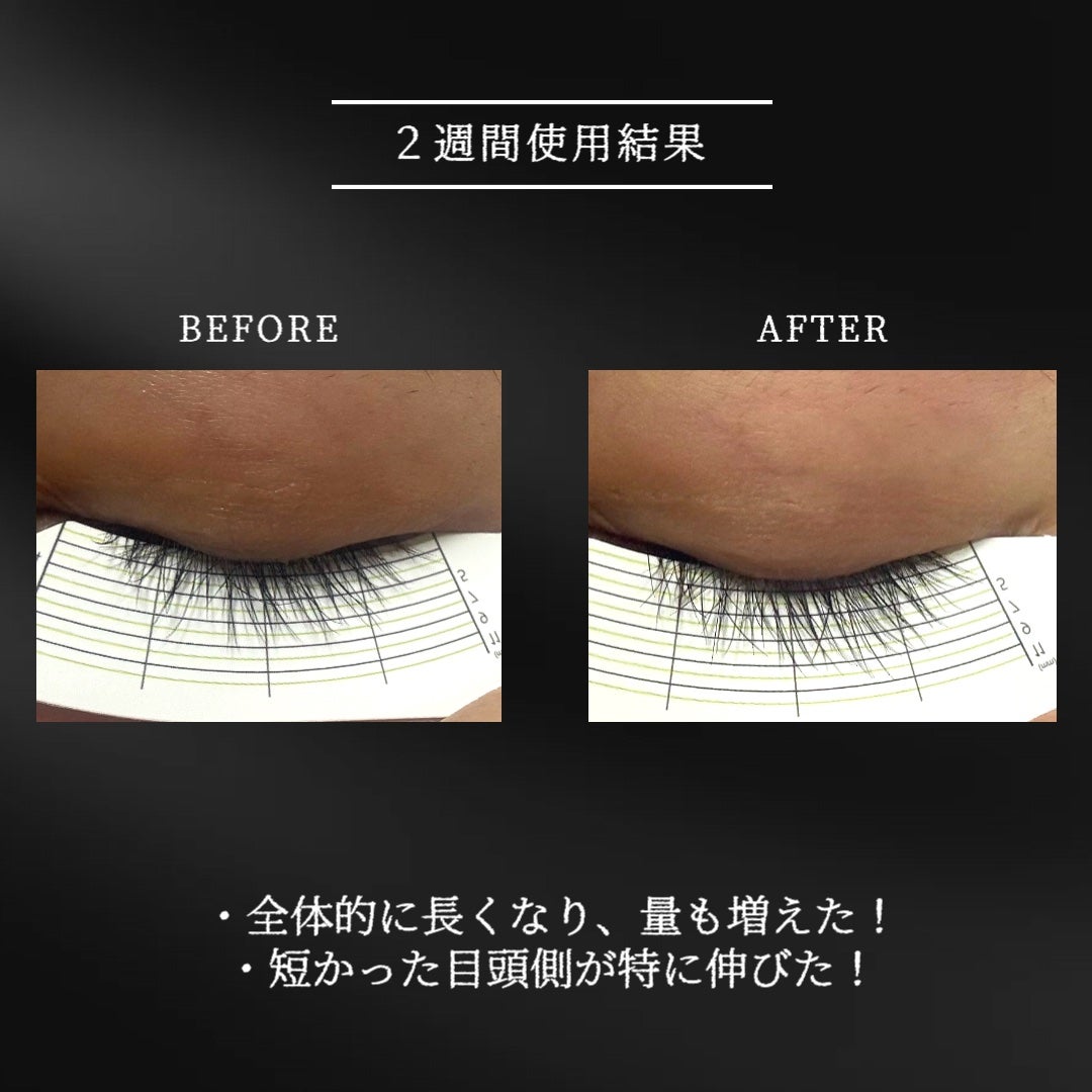 アーニストアイラッシュセラム/BENTON/まつげ美容液を使ったクチコミ(3枚目)