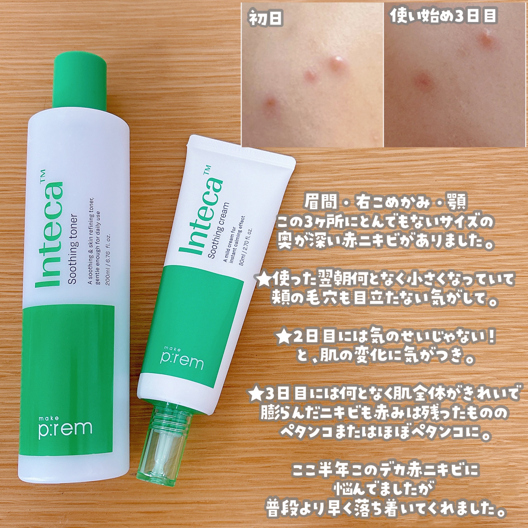 インテカ スージングトナー/make prem/化粧水を使ったクチコミ（2枚目）