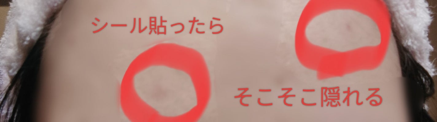 ティーツリーカーミングスポットパッチ/MEDIHEAL/その他スキンケアを使ったクチコミ(6枚目)