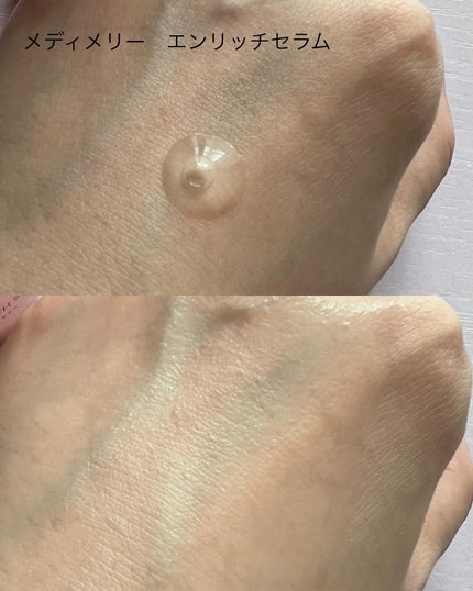 メディメリー ピュアウォーターローション/MEDIMERRY/化粧水を使ったクチコミ(4枚目)