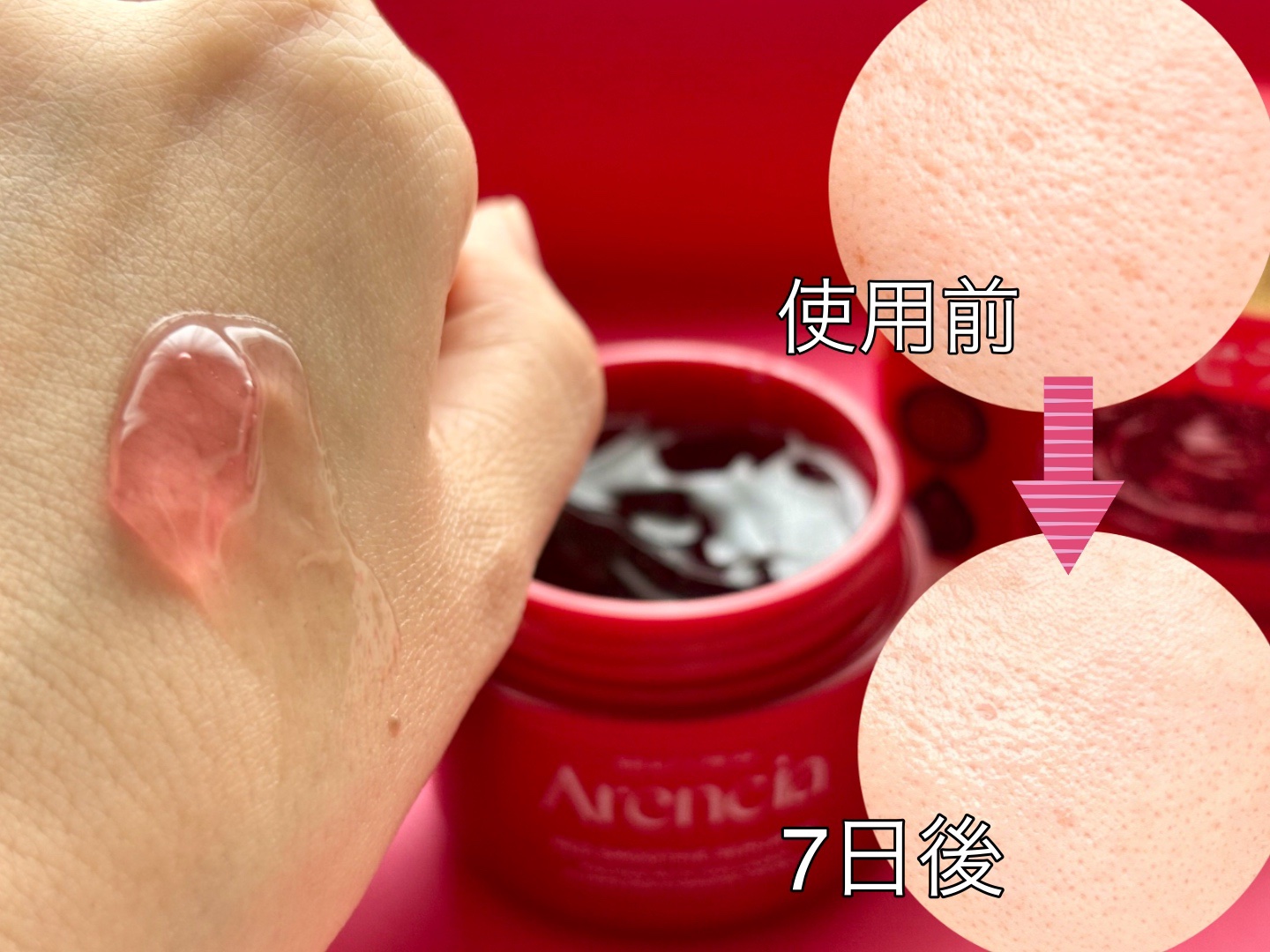 レッドモチセラム30/アレンシア/美容液を使ったクチコミ（3枚目）