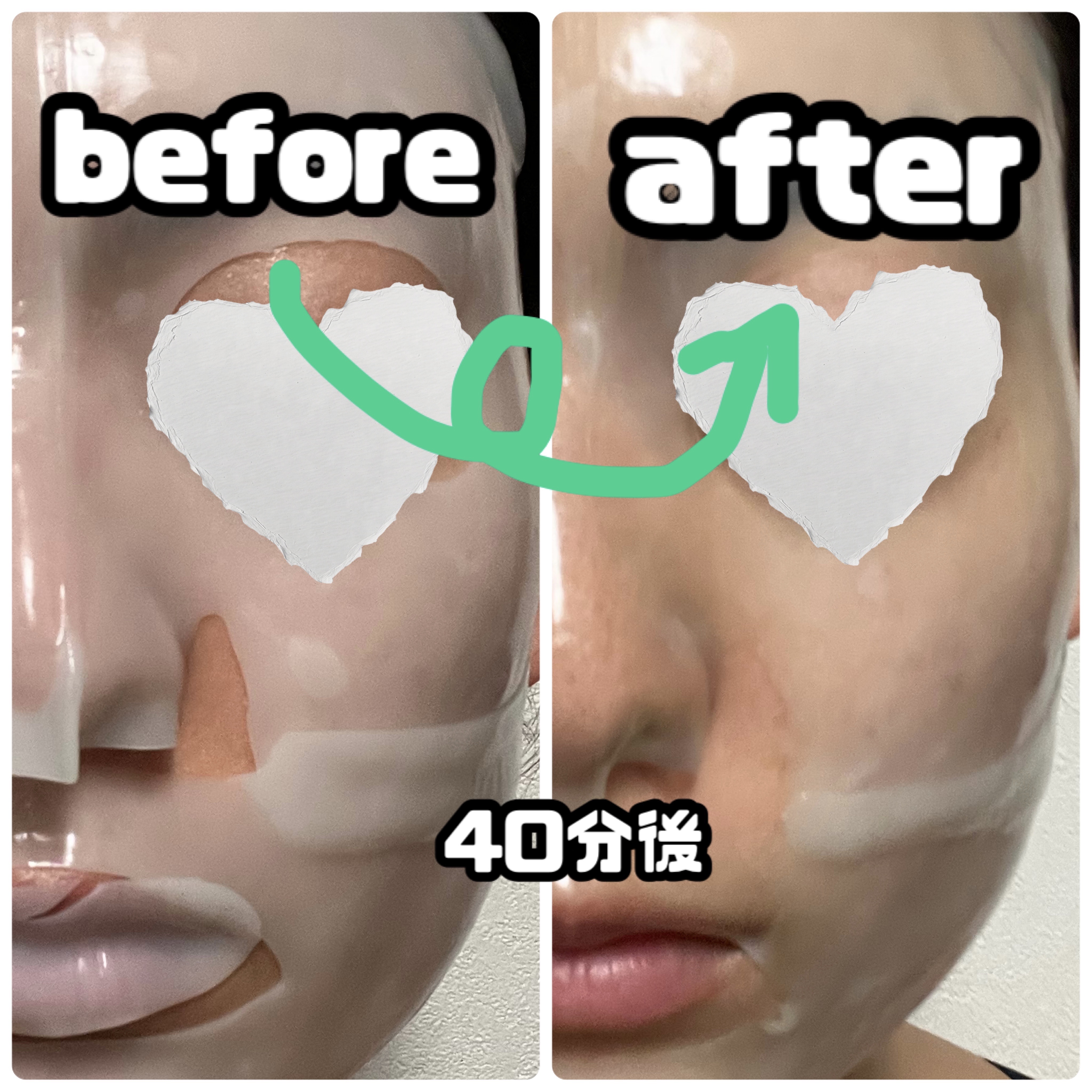 レチA リードルショット100 2ステップハイドロゲルマスク/VT/シートマスク・パックを使ったクチコミ（3枚目）