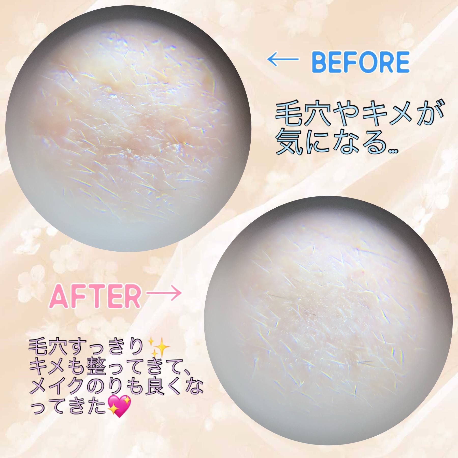 プロCICAリードルショット100/VT/ブースター・導入液を使ったクチコミ（2枚目）