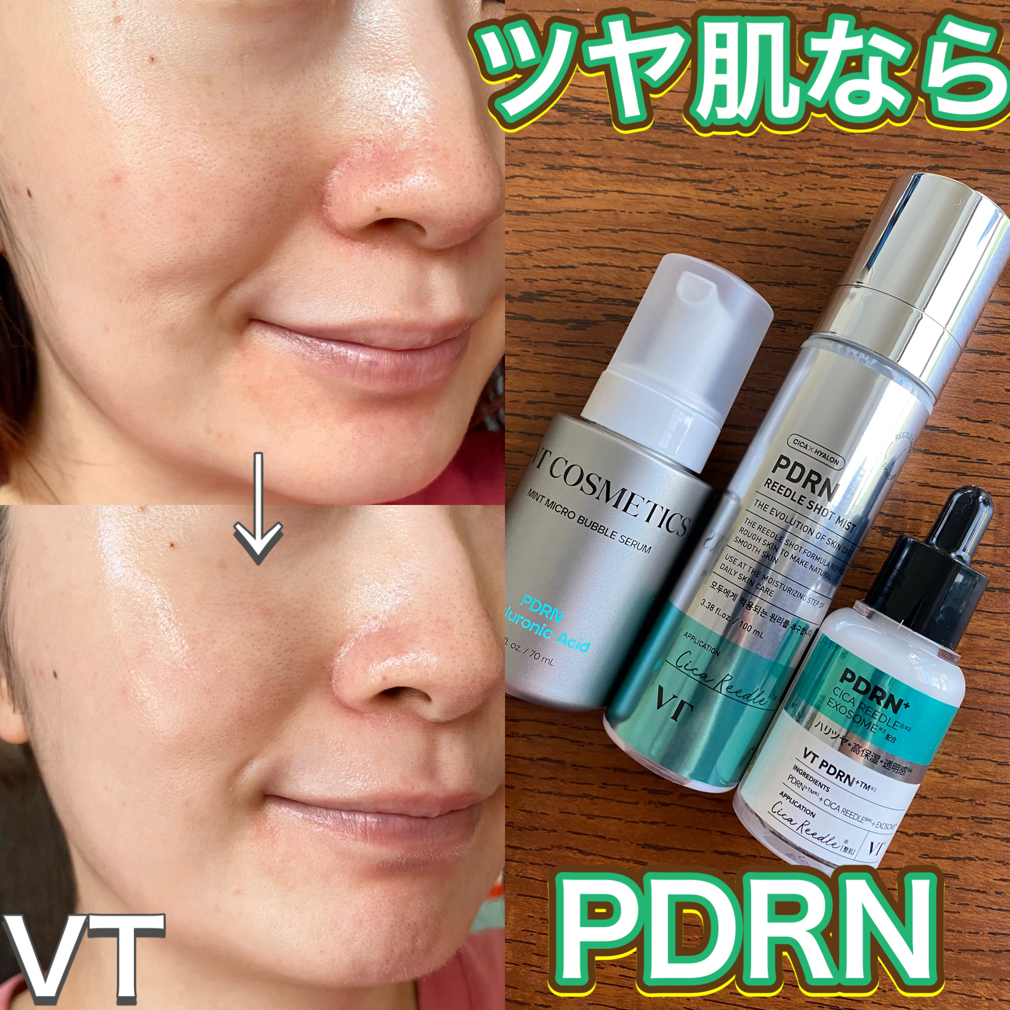 リードルS PDRN+ セラム/VT/美容液を使ったクチコミ（1枚目）