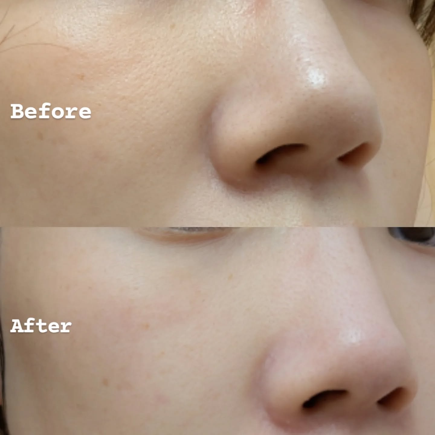 プレミアムもちソープ「グリーンアルティザン」/アレンシア/その他洗顔料を使ったクチコミ（2枚目）