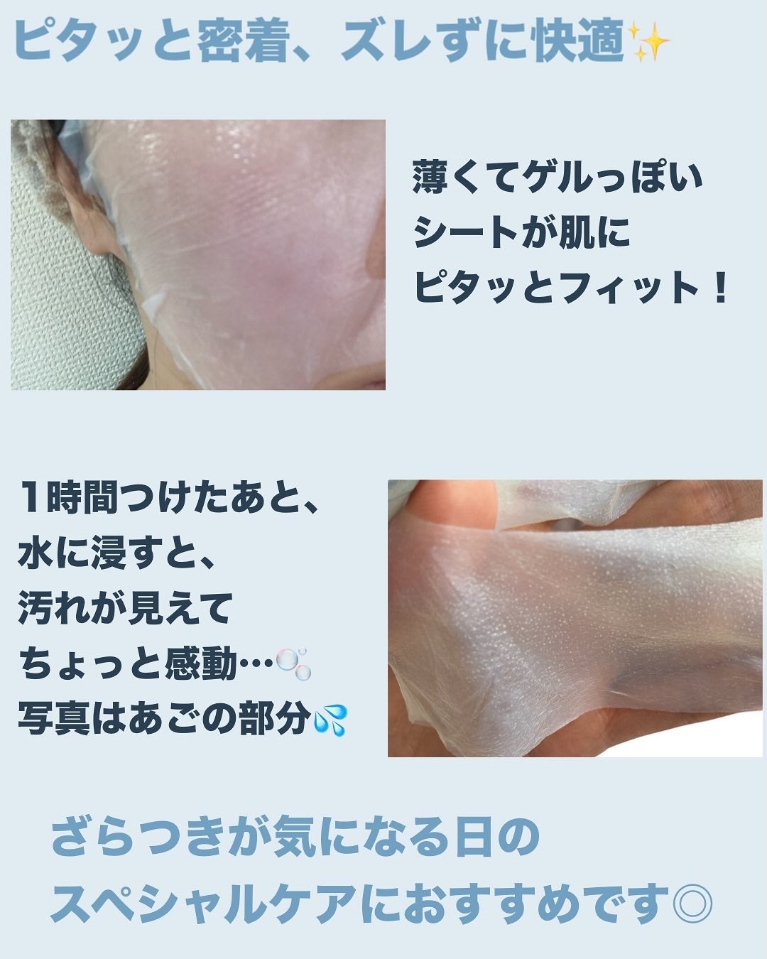 トラブルパッチマスク/EIOM/その他スキンケアを使ったクチコミ(3枚目)