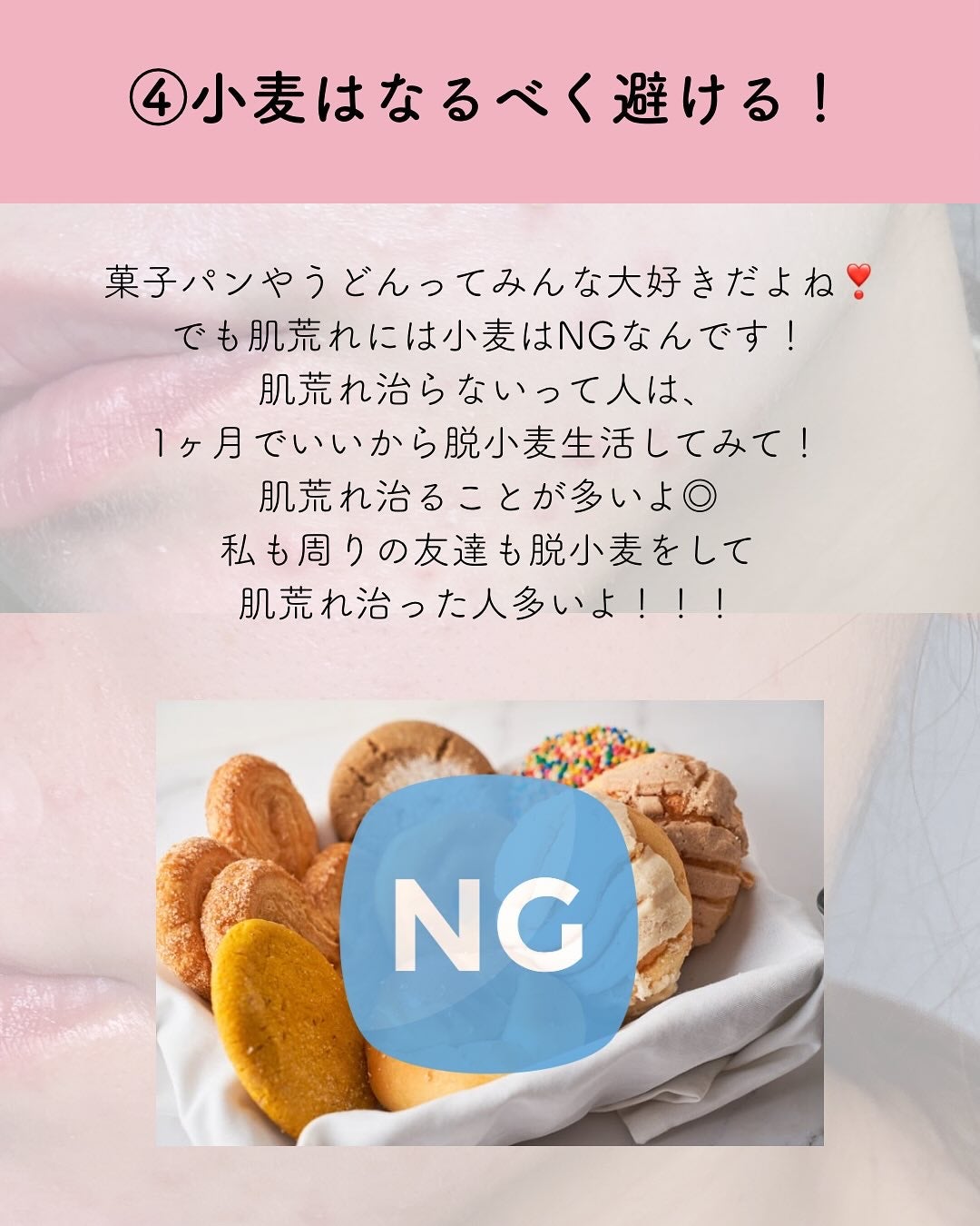 プロCICA クリアスポットパッチ/VT/その他スキンケアを使ったクチコミ(5枚目)