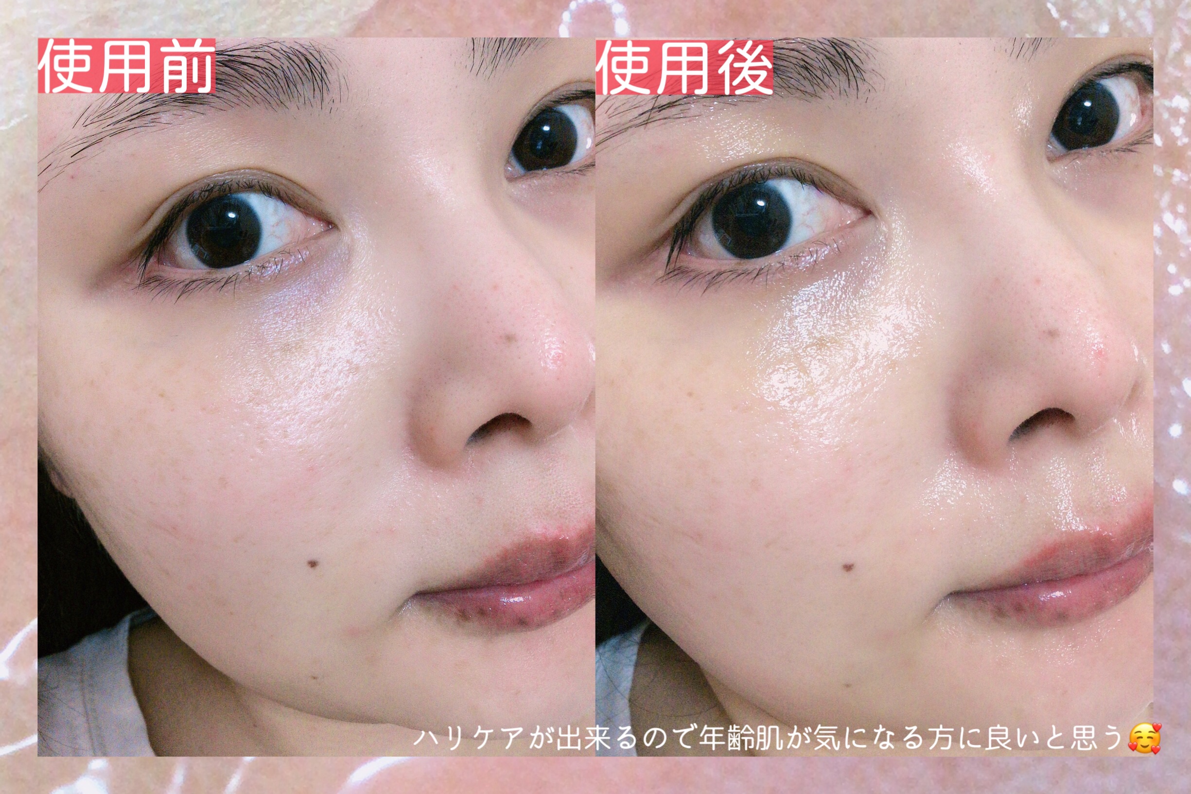 レッドモチセラム30/アレンシア/美容液を使ったクチコミ（3枚目）