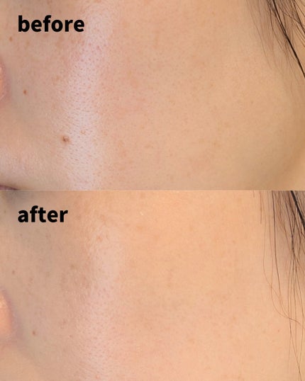 ステファニーエイジングカバー クッションファンデーション/STEFANY AGING COVER/クッションファンデーションを使ったクチコミ(5枚目)