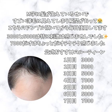 センティッドインテンシブスカルプアンプル/BANANAL/頭皮ローションを使ったクチコミ(4枚目)