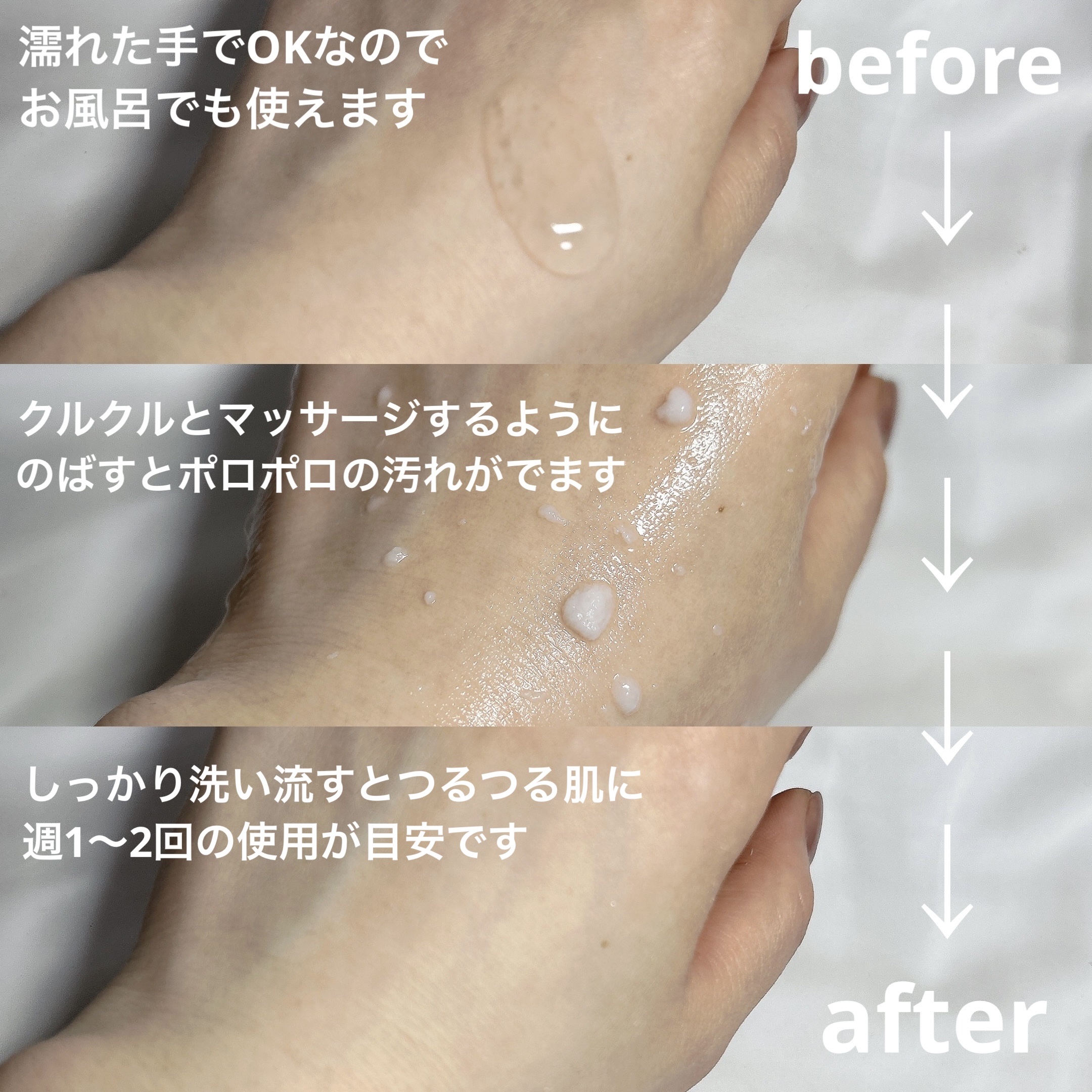 DETクリア ブライト＆ピール ピーリングジェリー＜無香料タイプ＞/Detclear/ピーリングを使ったクチコミ（2枚目）