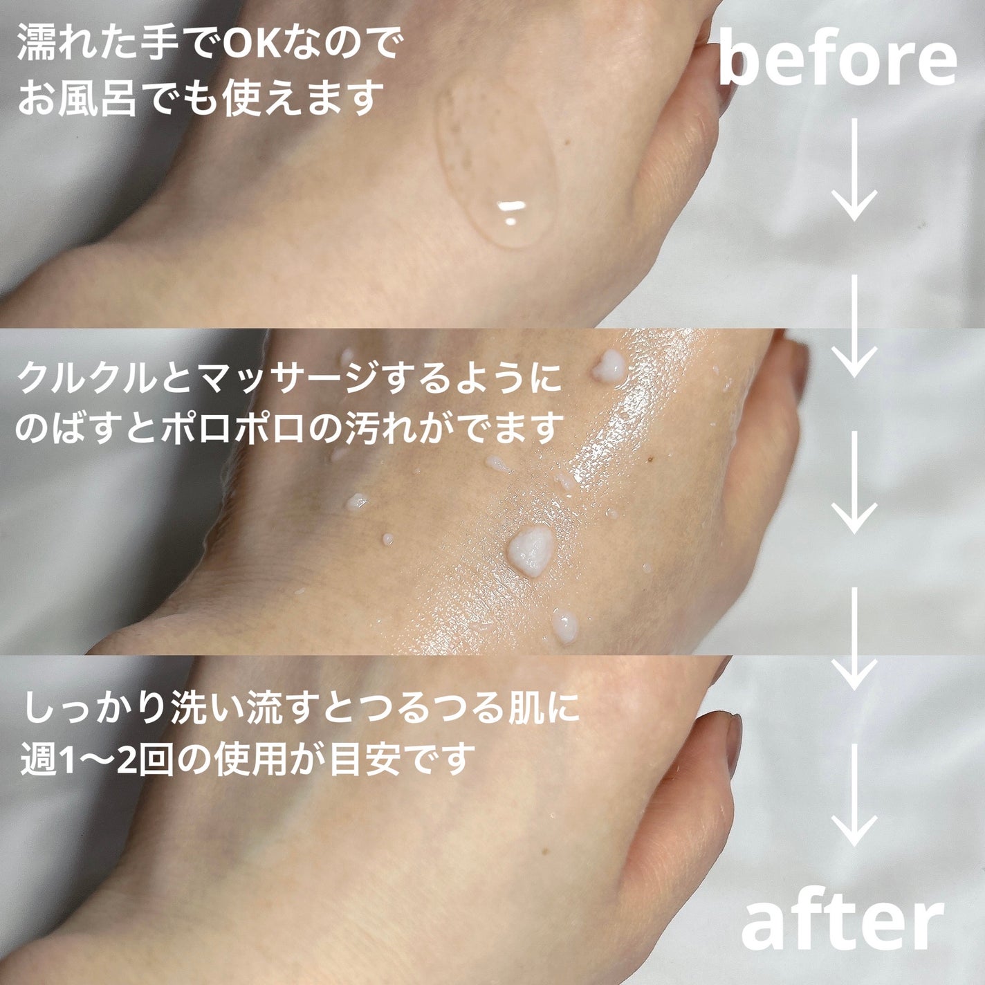 DETクリア ブライト&ピール ピーリングジェリー<無香料タイプ>/Detclear/ピーリングを使ったクチコミ(2枚目)