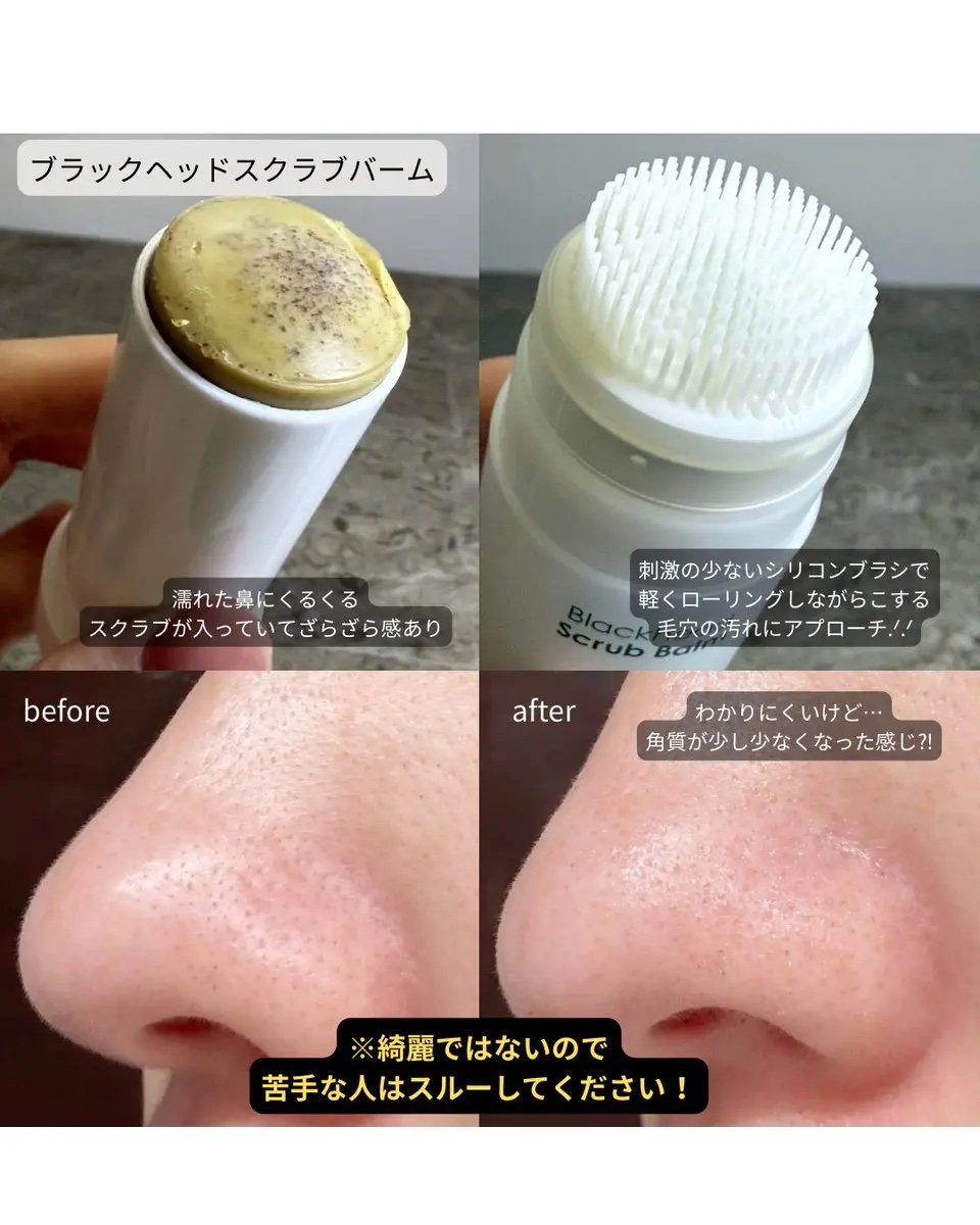 ブラックヘッドバームスクラブ/オブジェ/フェイスバームを使ったクチコミ（2枚目）