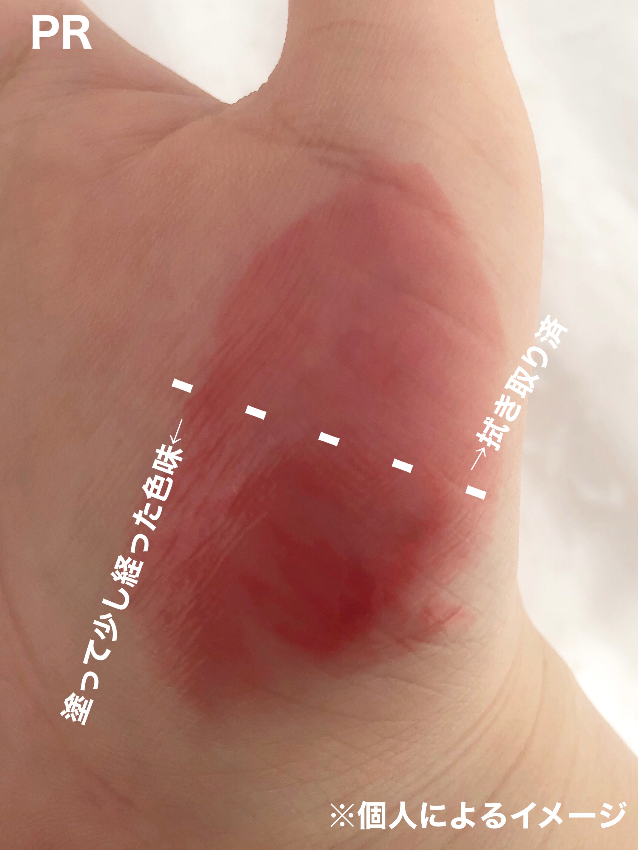 ポッピングバルーンティント/Laka/リップティントを使ったクチコミ（2枚目）