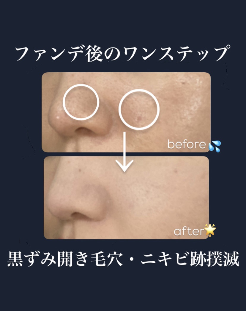 マシュマロフィニッシュパウダー/キャンメイク/プレストパウダーを使ったクチコミ（1枚目）