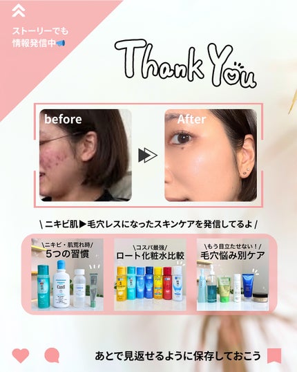 グリーンマイルドアップサンプラス/Dr.G/日焼け止めクリームを使ったクチコミ(9枚目)