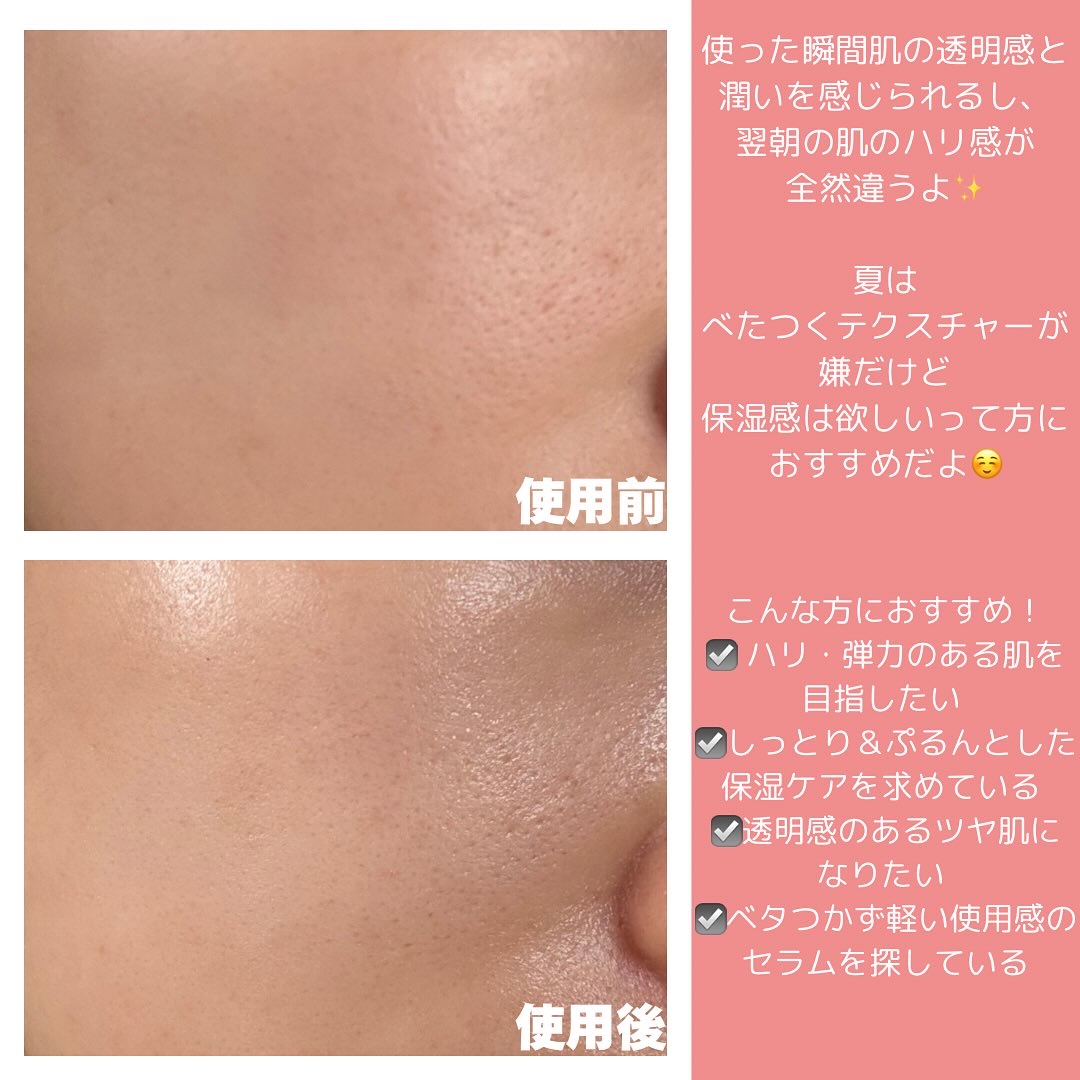 レッドモチセラム30/アレンシア/美容液を使ったクチコミ（3枚目）