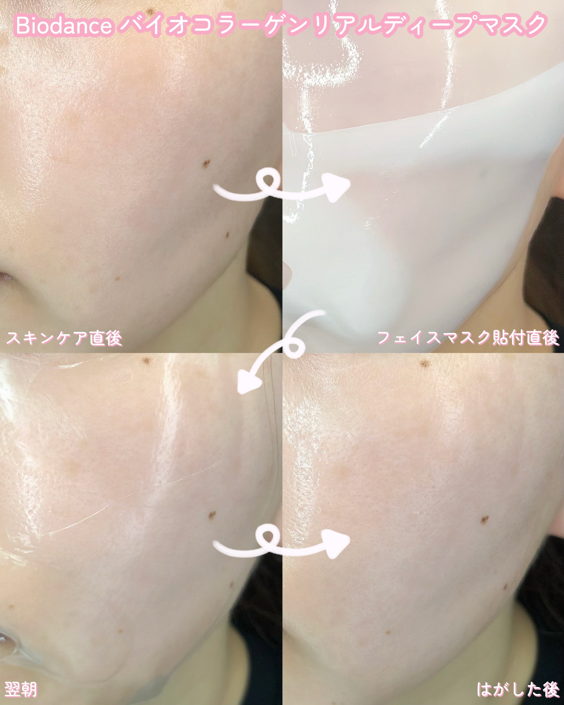 バイオコラーゲンリアルディープマスク/Biodance/シートマスク・パックを使ったクチコミ（3枚目）