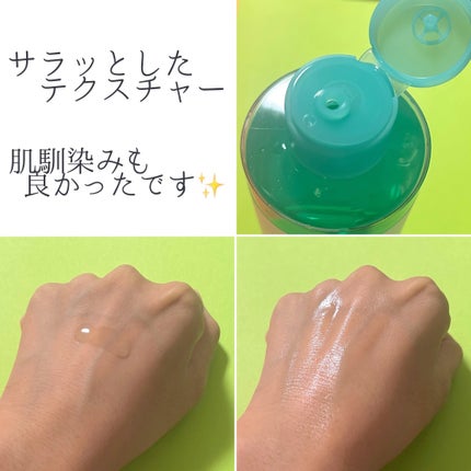 ã¢ãŒã©ã€ã³é
žãã€ã¢ã·ã³ã¢ããã¯ãªã¢ãããŒ/MEDICUBE/åç²§æ°Žã䜿ã£ãã¯ãã³ãïŒ2æç®ïŒ