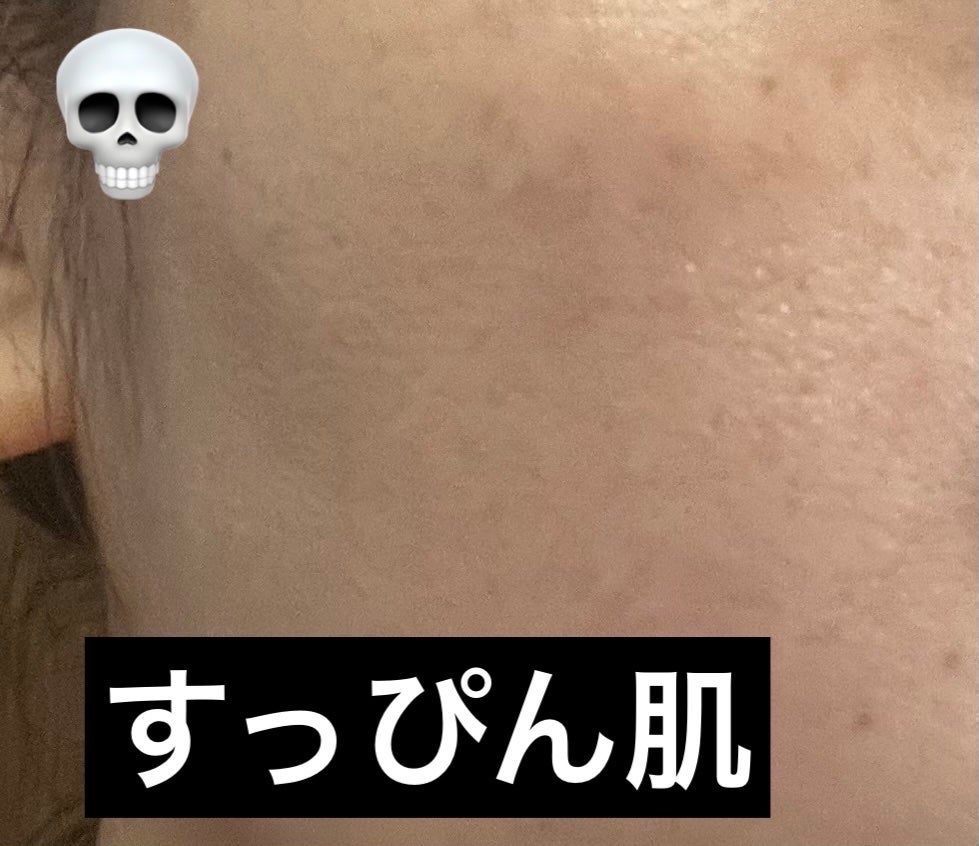 KM ルースパウダー/DAISO/ルースパウダーを使ったクチコミ(3枚目)