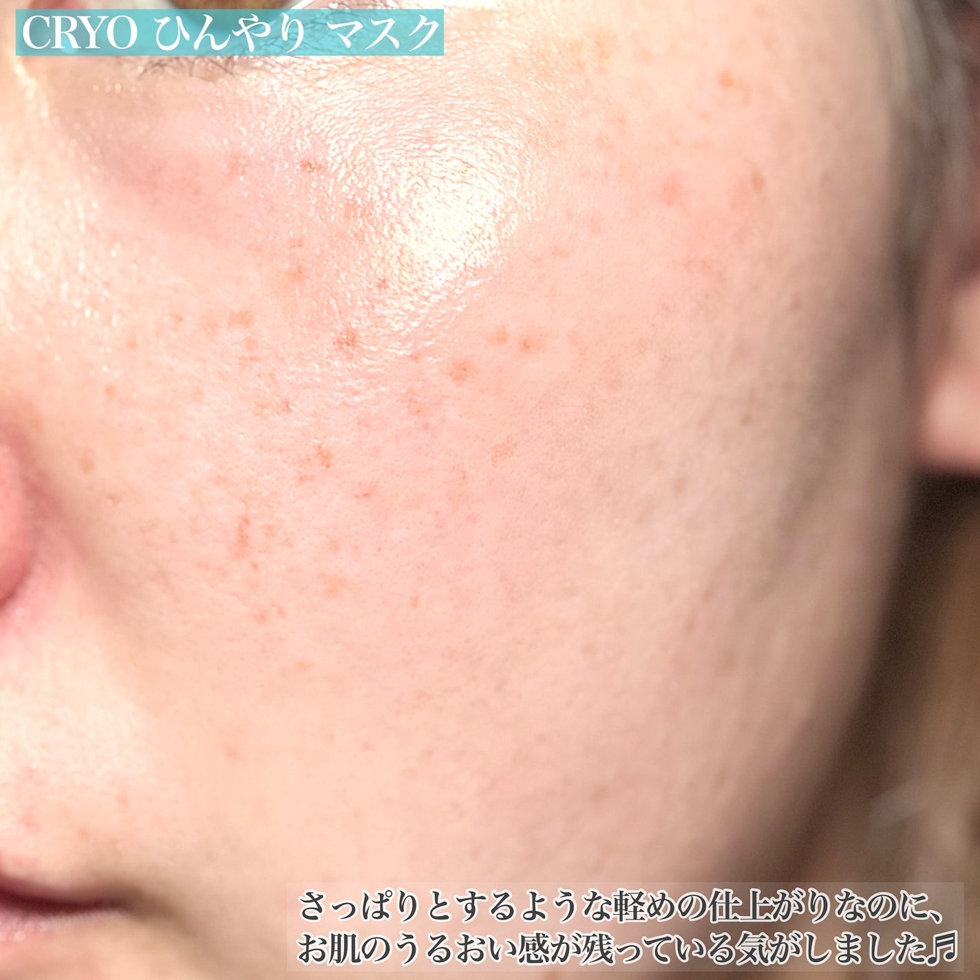 クライオひんやりスキンパック/VT/その他スキンケアを使ったクチコミ(7枚目)