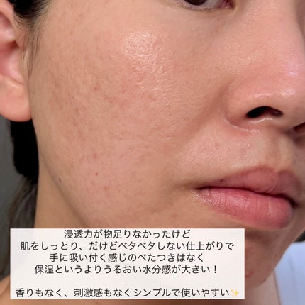 トランシーノ薬用ブライトニングクリアローション/トランシーノ/化粧水を使ったクチコミ(4枚目)