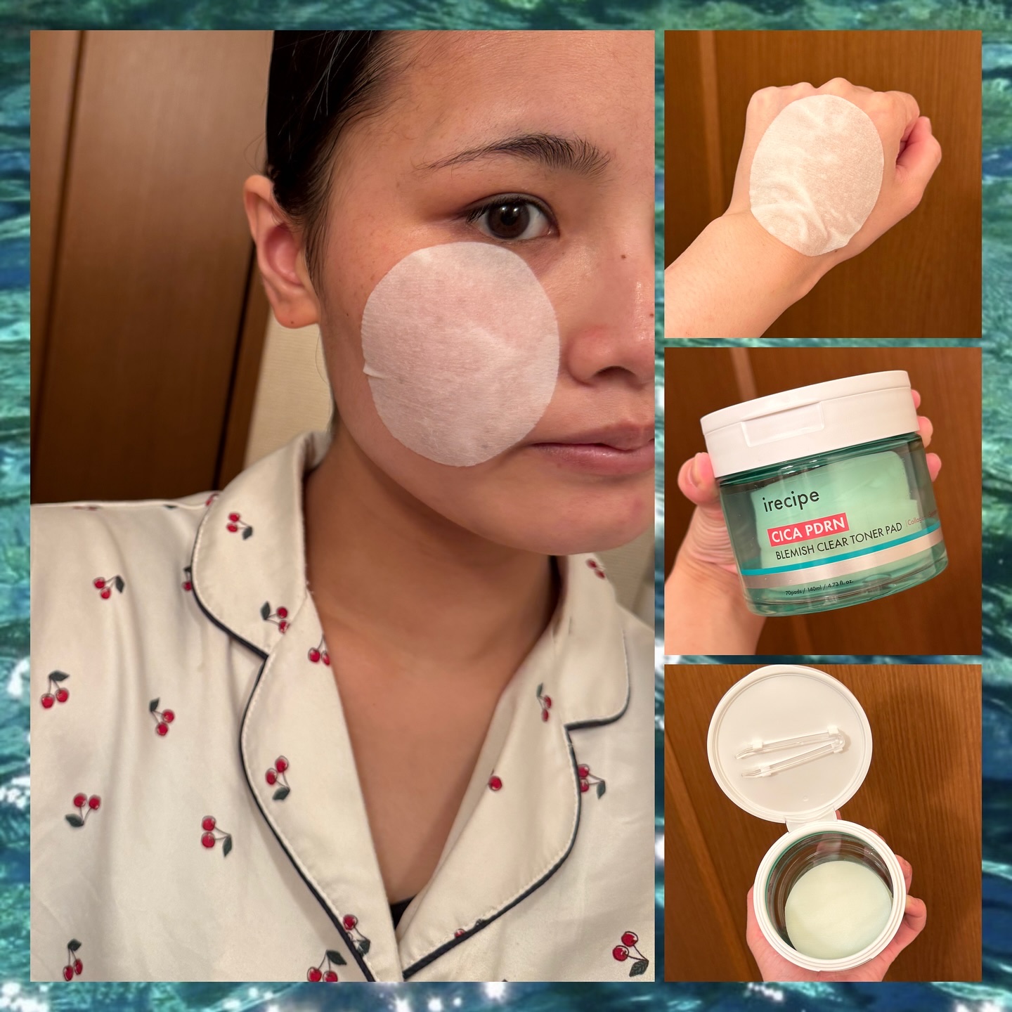 シカ PDRN 跡 クリアー トナーパッド/irecipe/トナーパッドを使ったクチコミ（2枚目）