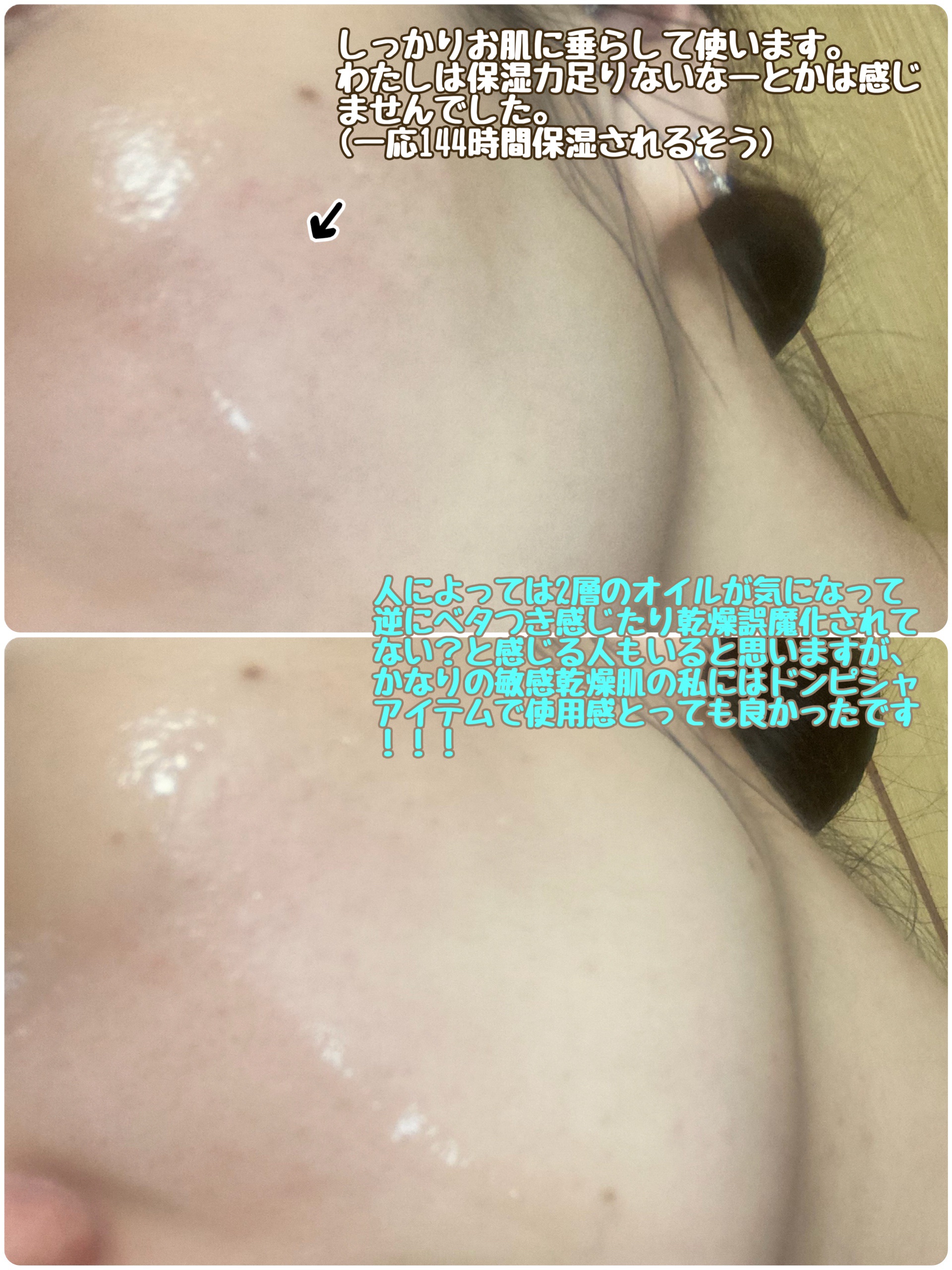 ヒアルロン酸マルチペプチドセラム/MEDICUBE/美容液を使ったクチコミ（3枚目）