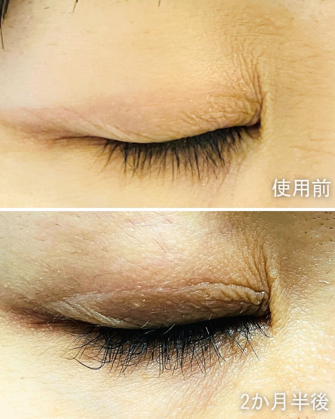 ラッシュアディクト アイラッシュコンディショニングセラム/soaddicted/まつげ美容液を使ったクチコミ（3枚目）