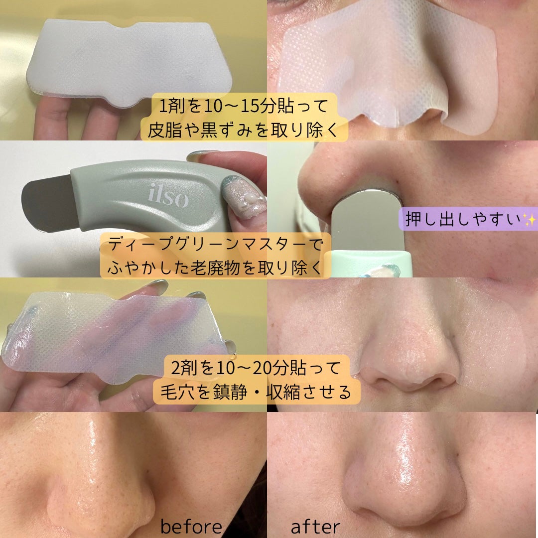 ナチュラルマイルドクリアノーズパック/ilso/シートマスク・パックを使ったクチコミ(3枚目)