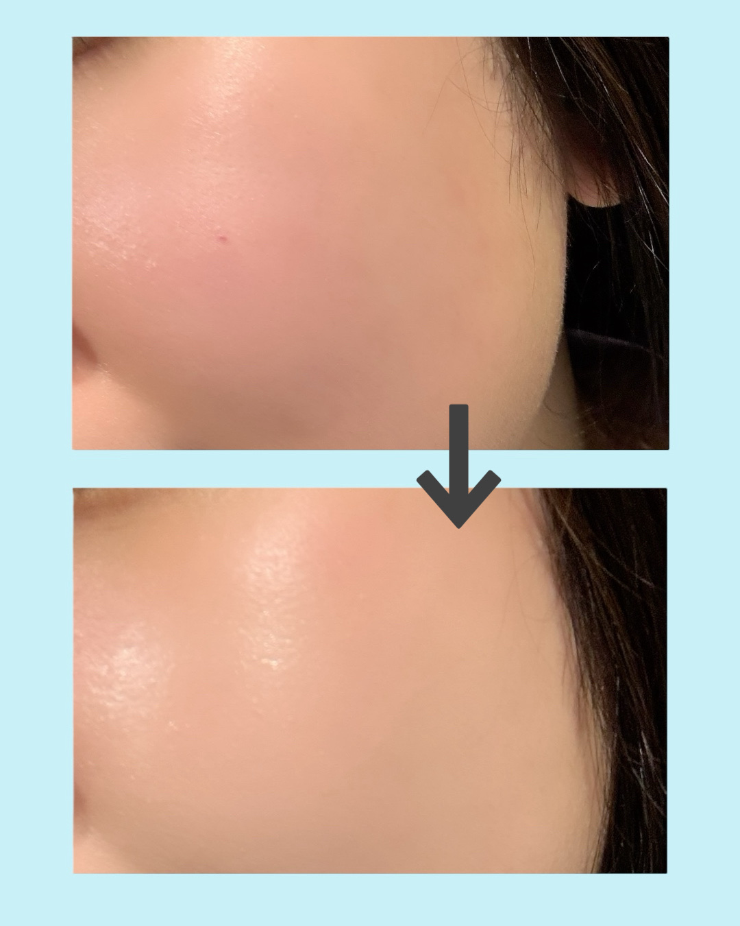 ヘルシーグロウクッション/heyooo/クッションファンデーションを使ったクチコミ（3枚目）